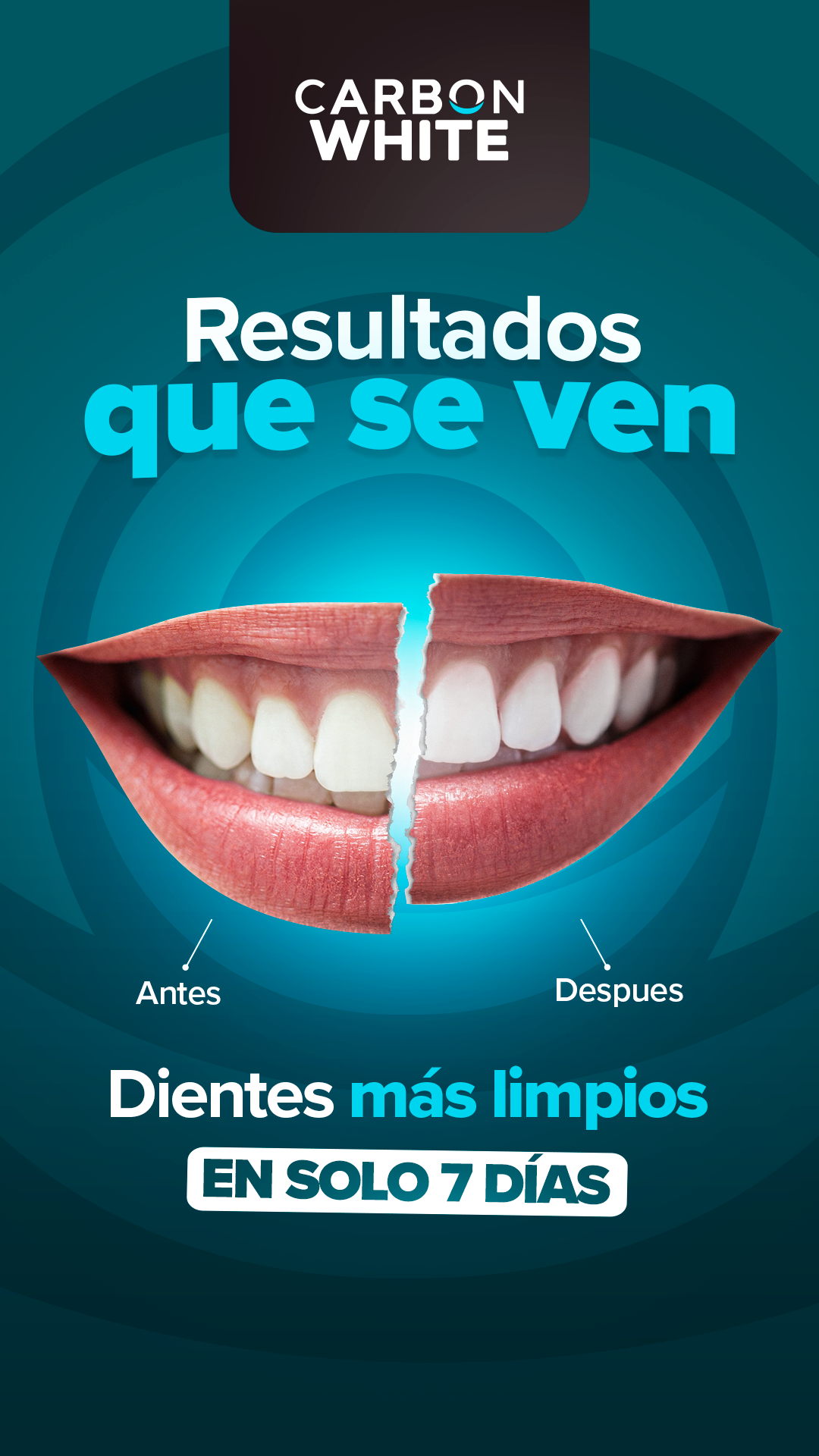 Blanqueador Dental Orgánico Carbon Activado Vegetal Dientes Blancos